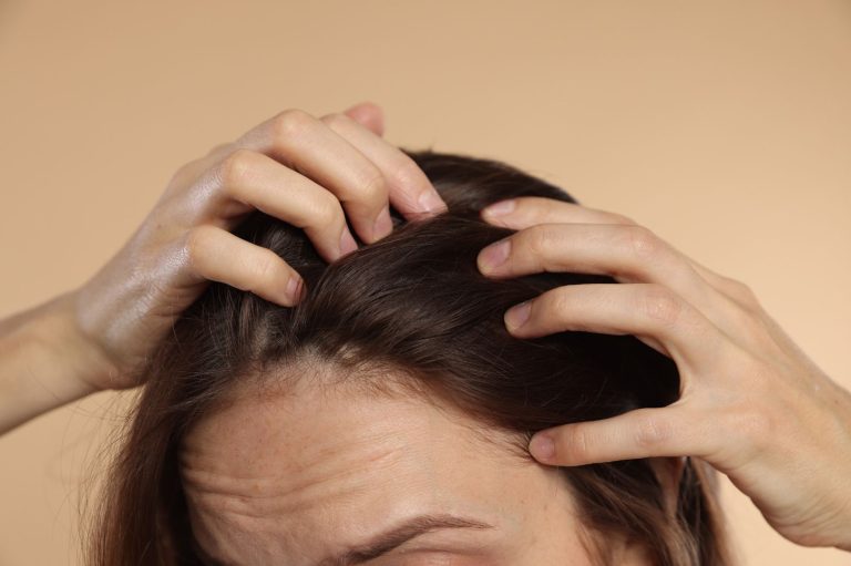 Woman examining hairline thinning linked to hormone imbalance and hair loss in women